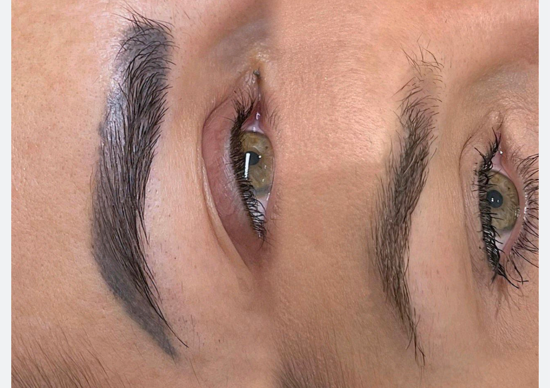 🇺🇦Remover -indepartare micropigmentare 