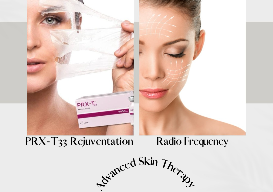 Advanced PRX-T33 rejuvenation with Radio Frequency