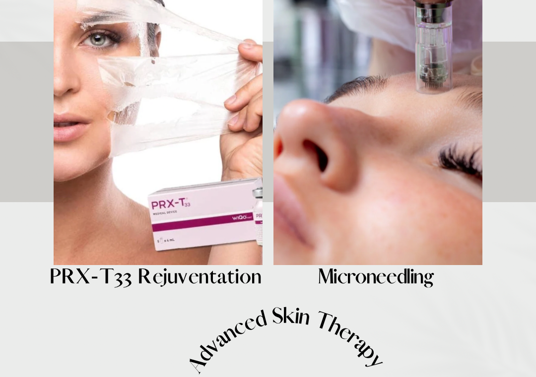 Advanced PRX-T33 treatment with Microneedling 