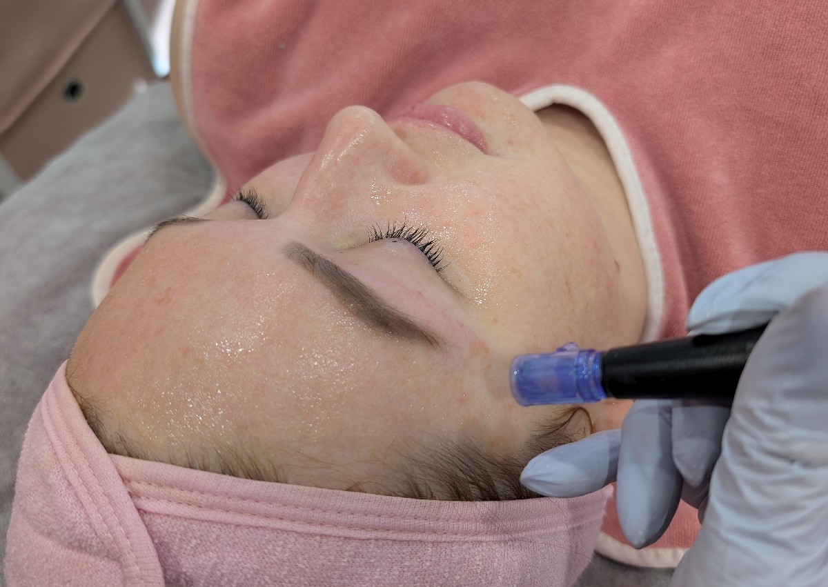 Infusion Facial
