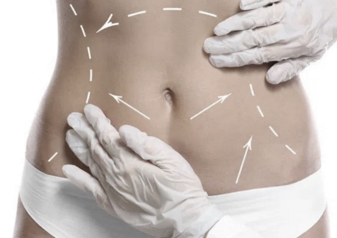 Post Surgery Lymphatic Drainage Session