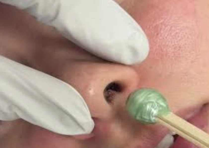 Nose Wax