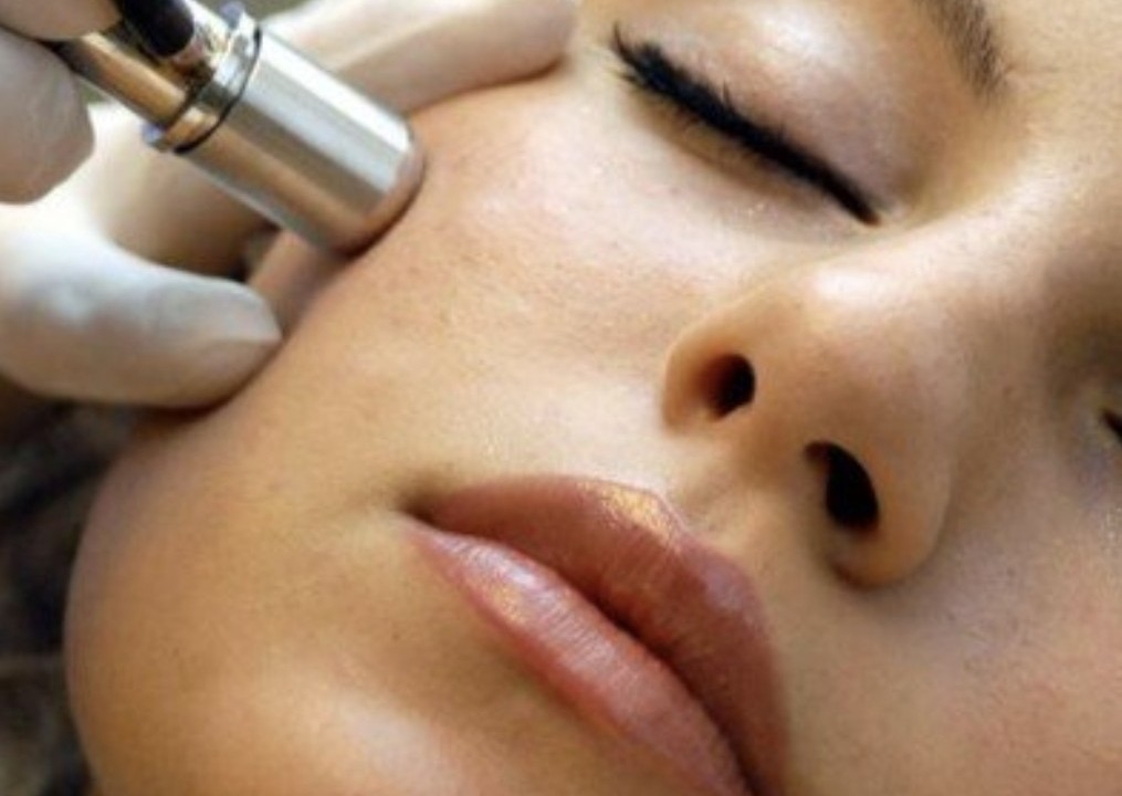 Microdermabrasion Facial