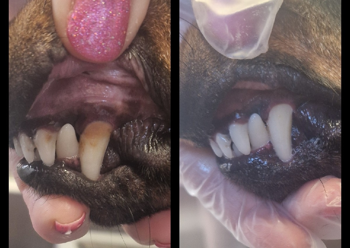 Ultrasonic teeth clean 