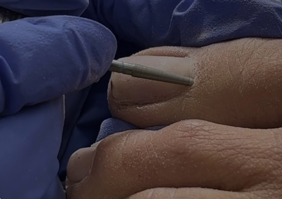 The Clean Toes (Level 1)