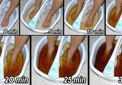 Desintoxicación Ionica 