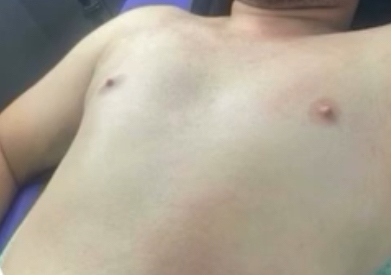 Depilacion  corporal 