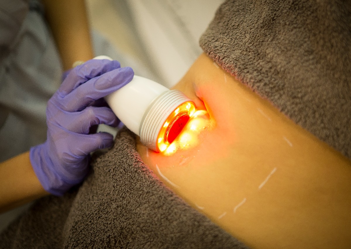 HImFU Ultracavitație 40 min