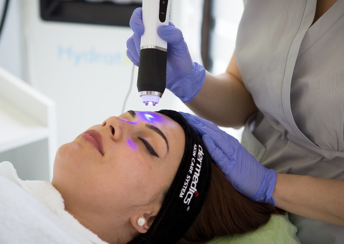 Radiofrecvență Facială 30 min