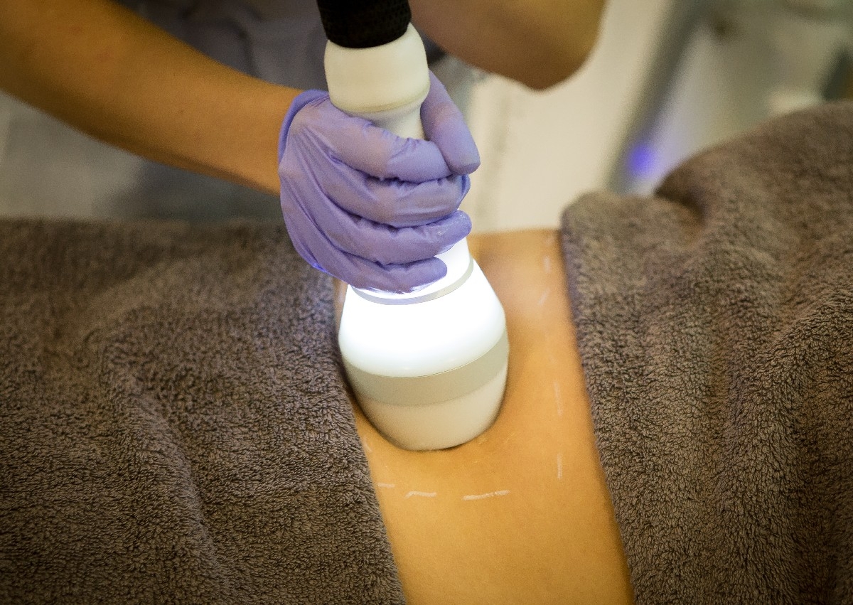 Crioradiofrecvență Corporală 40 min