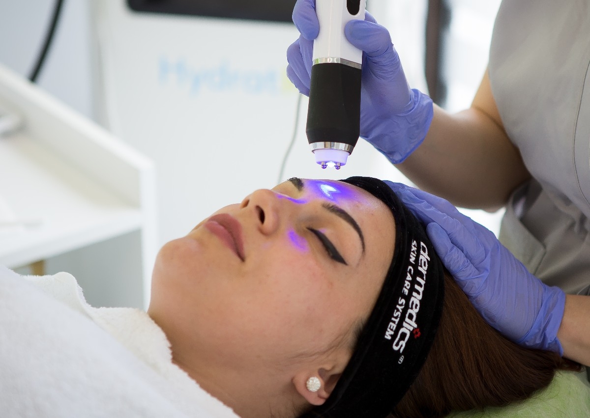 Radiofrecvență Facială 60 min