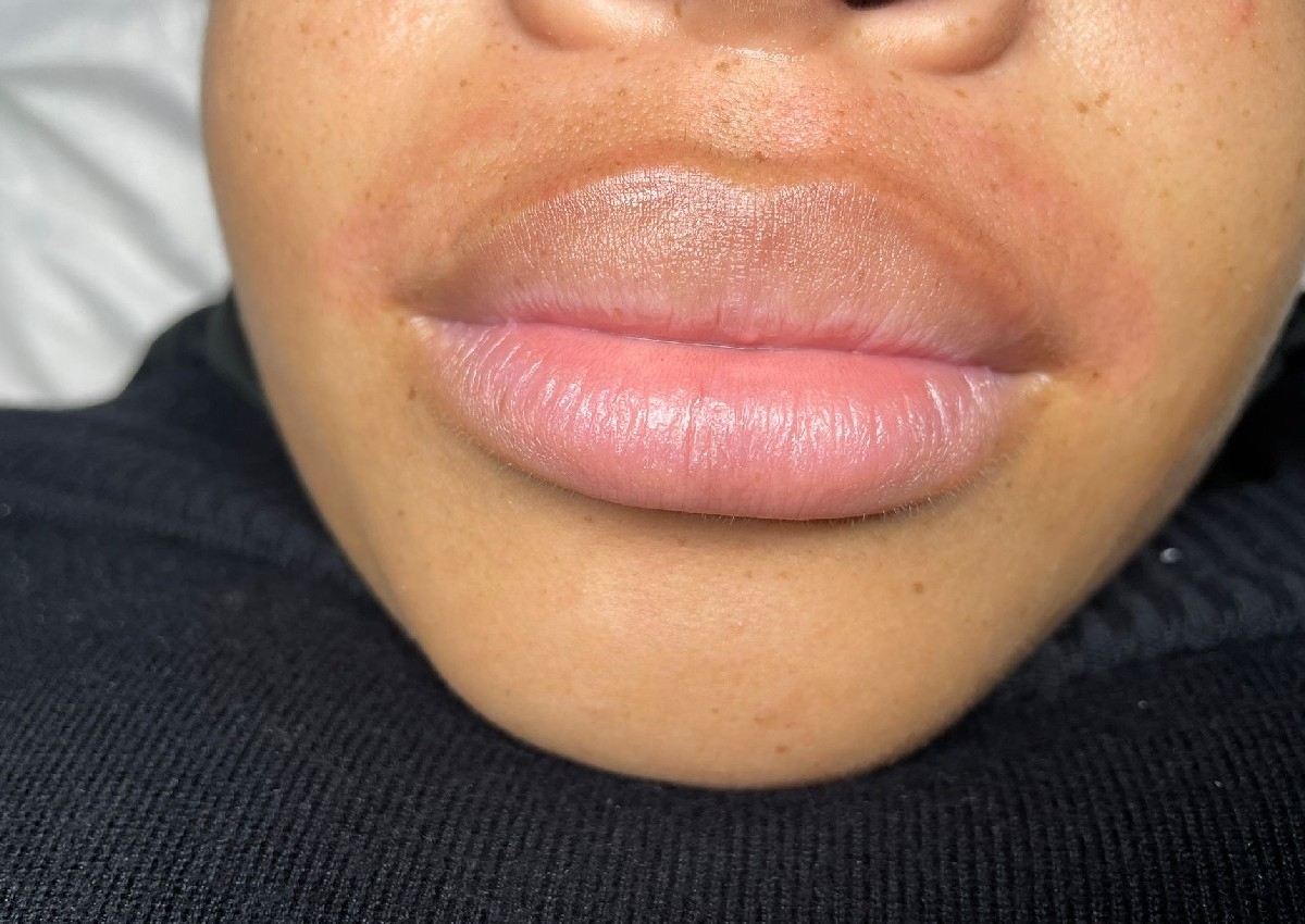 Upper Lip Wax