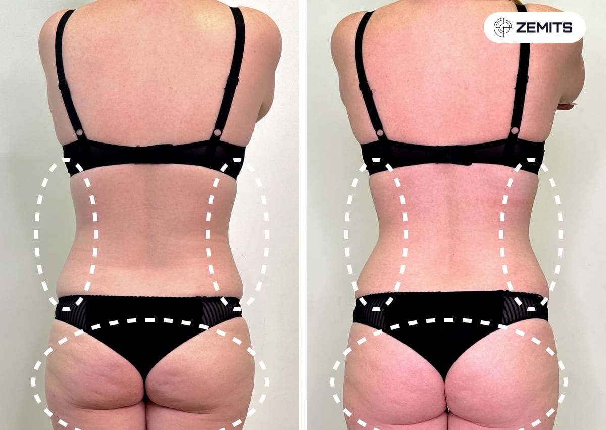 Bionexis  Back & Bra