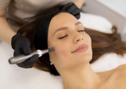 Microneedling course of 3 