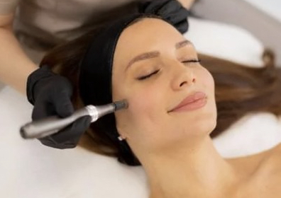 Microneedling facial