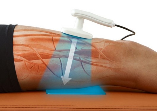 Sports Massage + radio frequency treatment