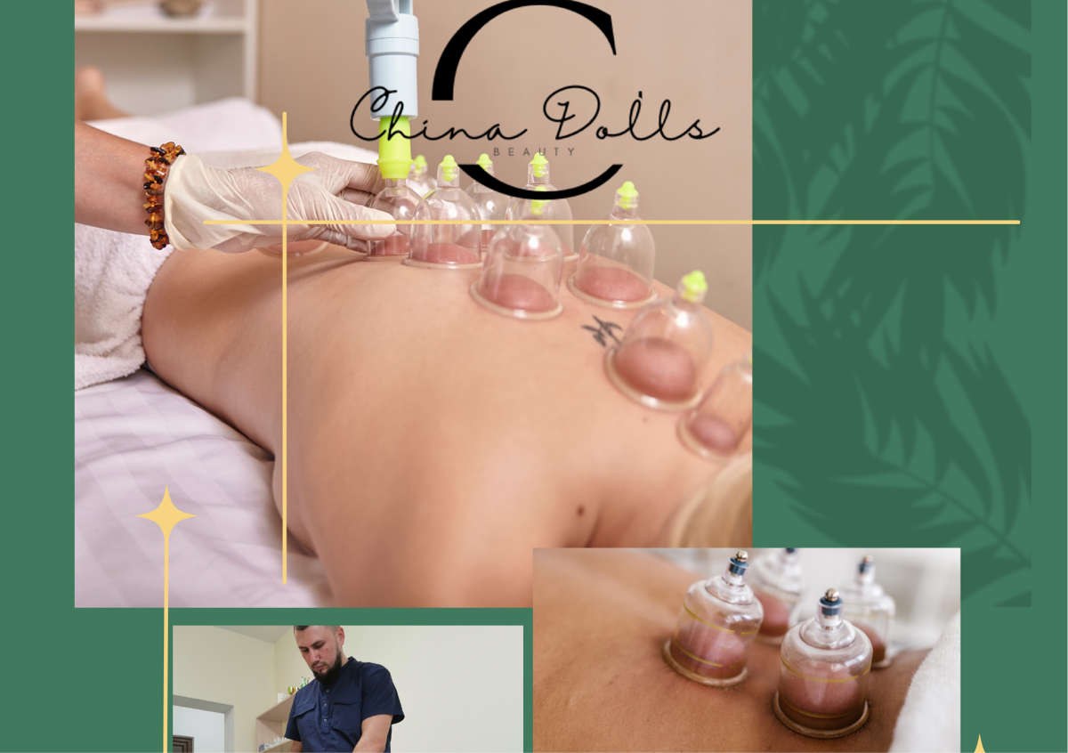 Cupping Therapy Promotion