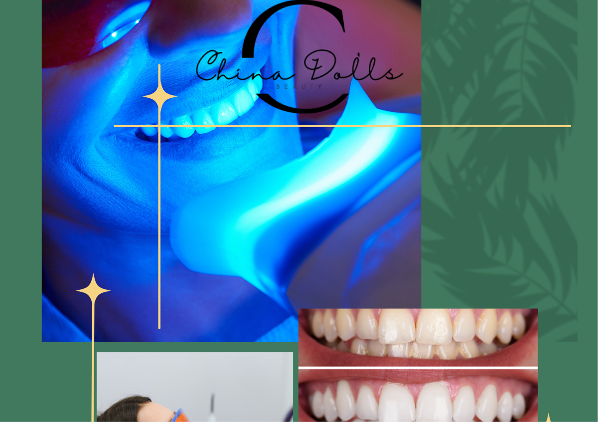 Teeth Whitening 