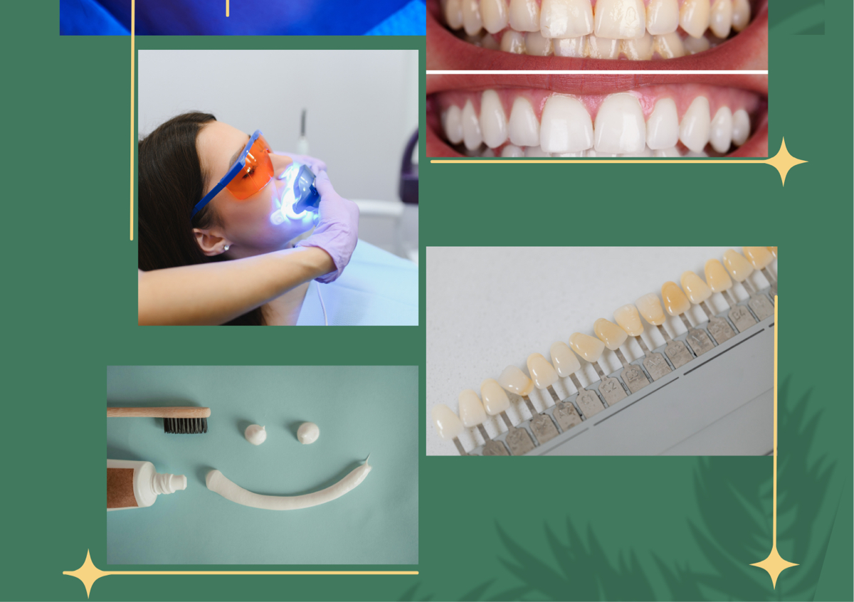 Teeth whitening Promo