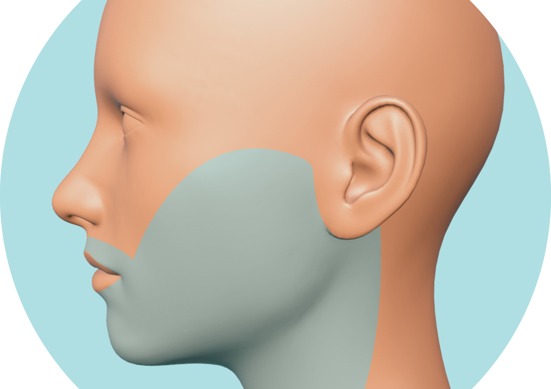 Depilación Láser Diodo - Rostro y Cuello