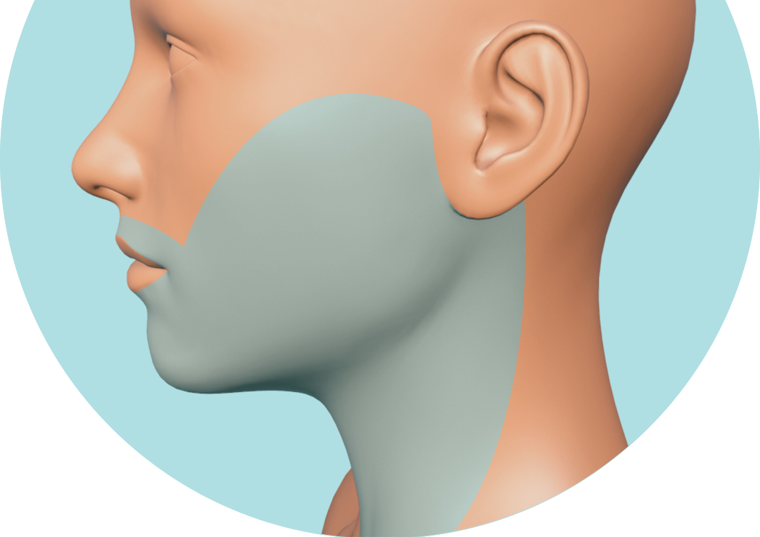 Depilación láser diodo Rostro y Cuello (6 Sesiones)