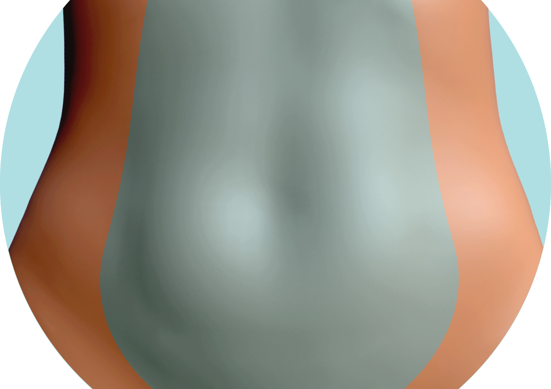 Depilación Láser Diodo  - Abdomen