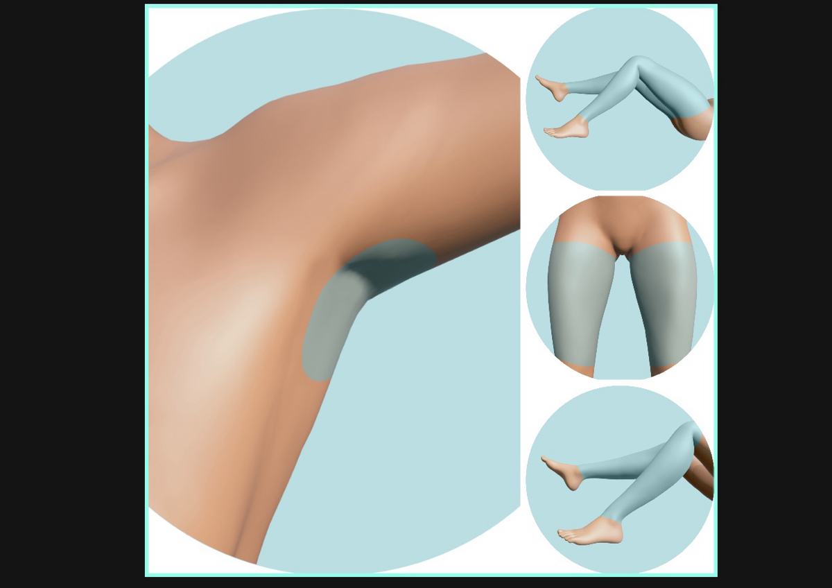 Depilación láser diodo Axilas + Piernas (Mitad o Completa) (3 Sesiones)