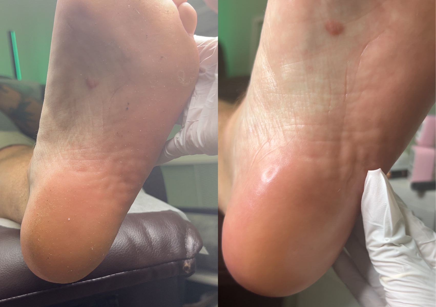 Pedicure one gel color (Basic foot care for not problematic heels)