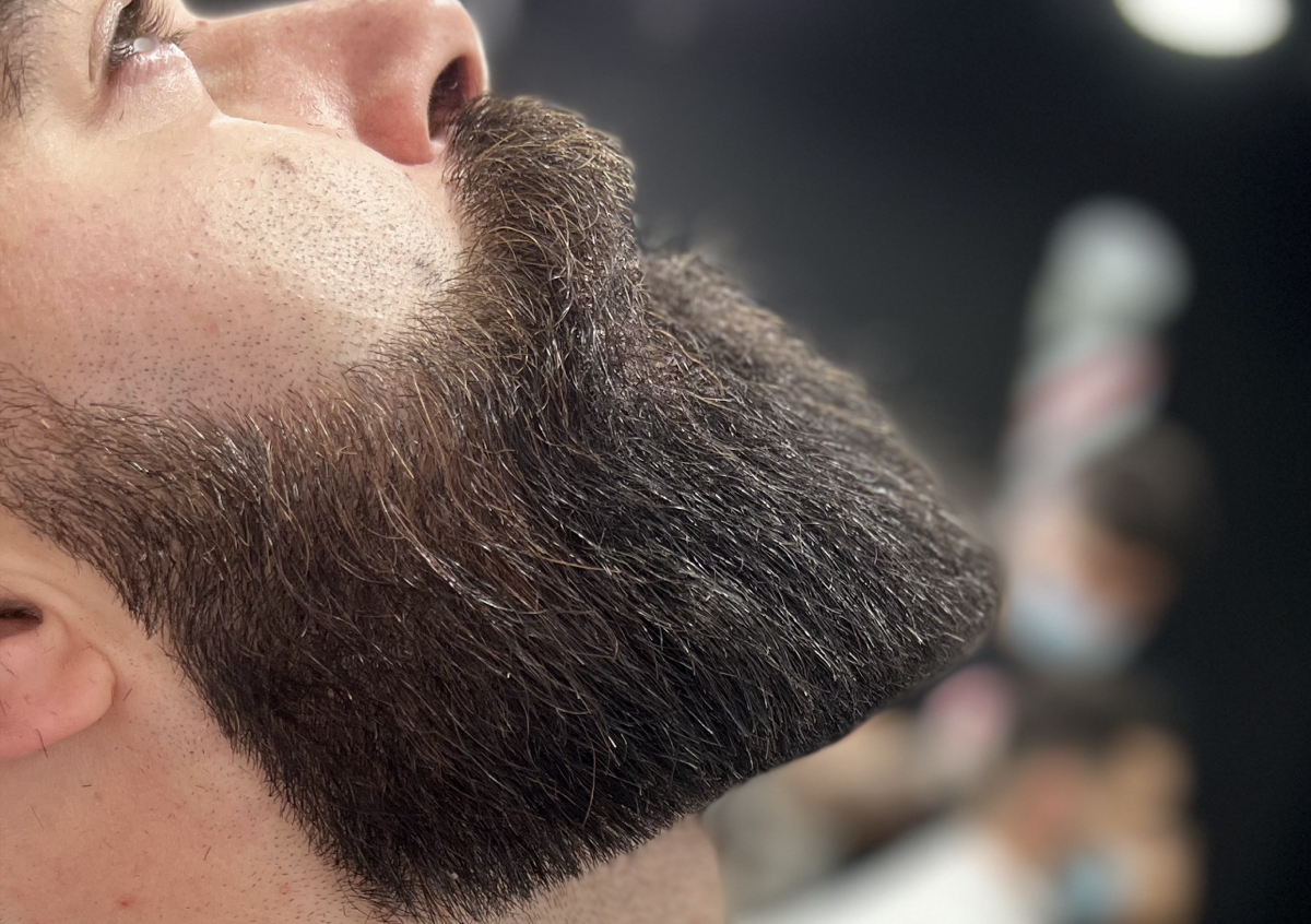 Total beard reshaping / Ολικη αναδομηση γενειαδας