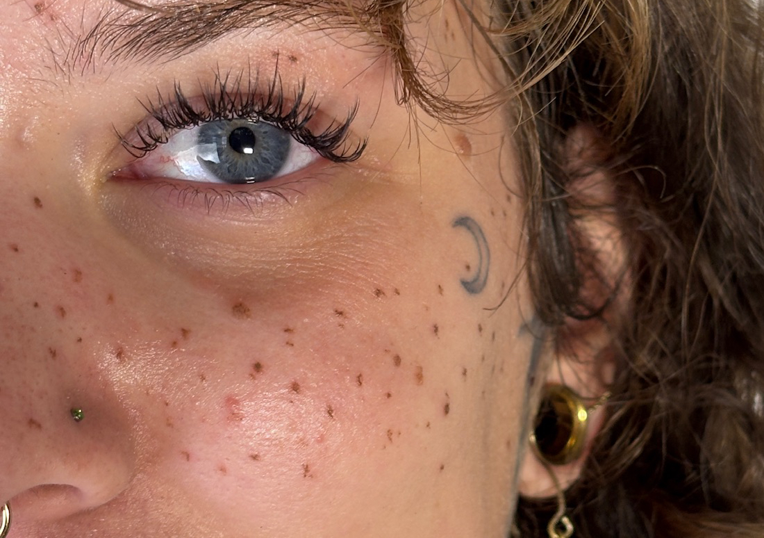 Faux Freckles