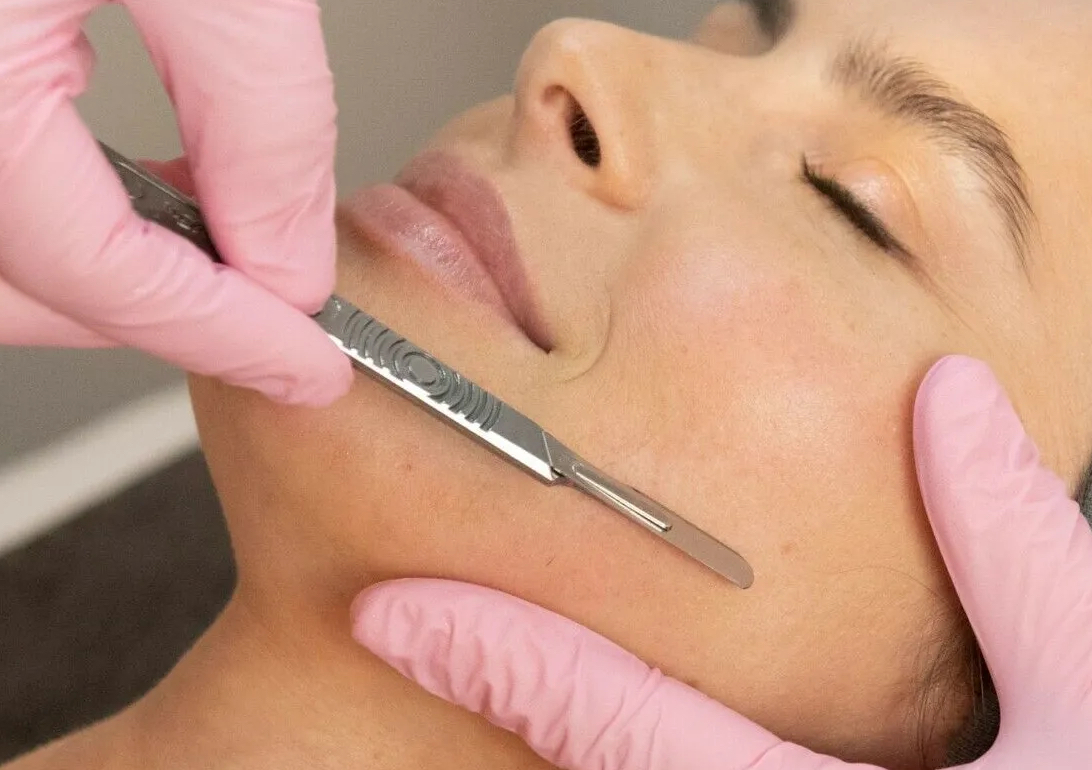 Dermaplaning