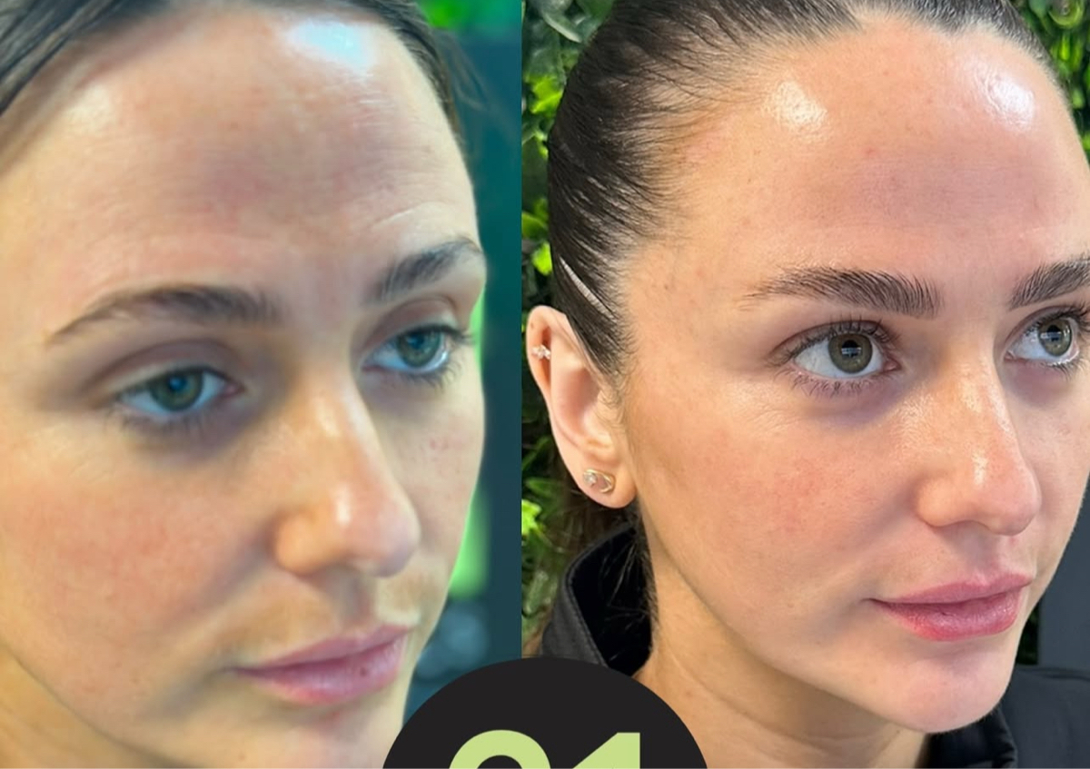 Vitaran - Polynucleotide