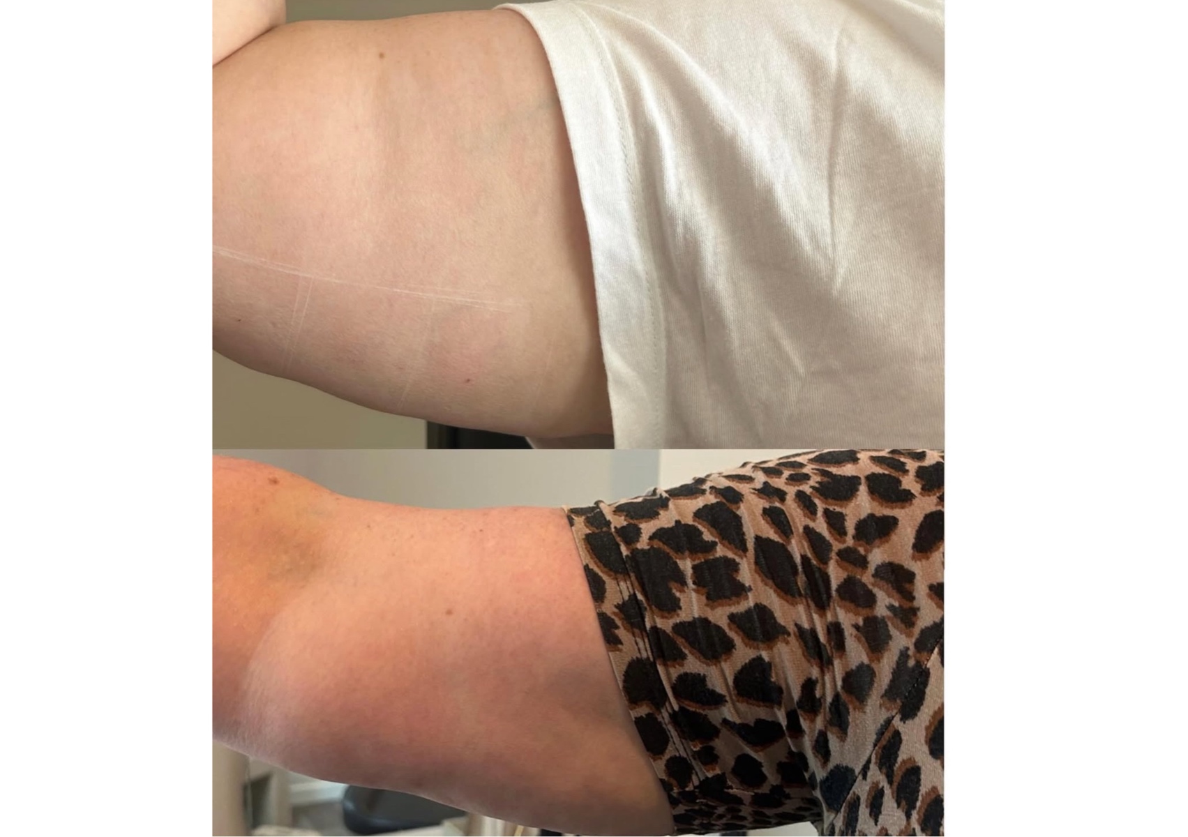 Lemon bottle - Medium area