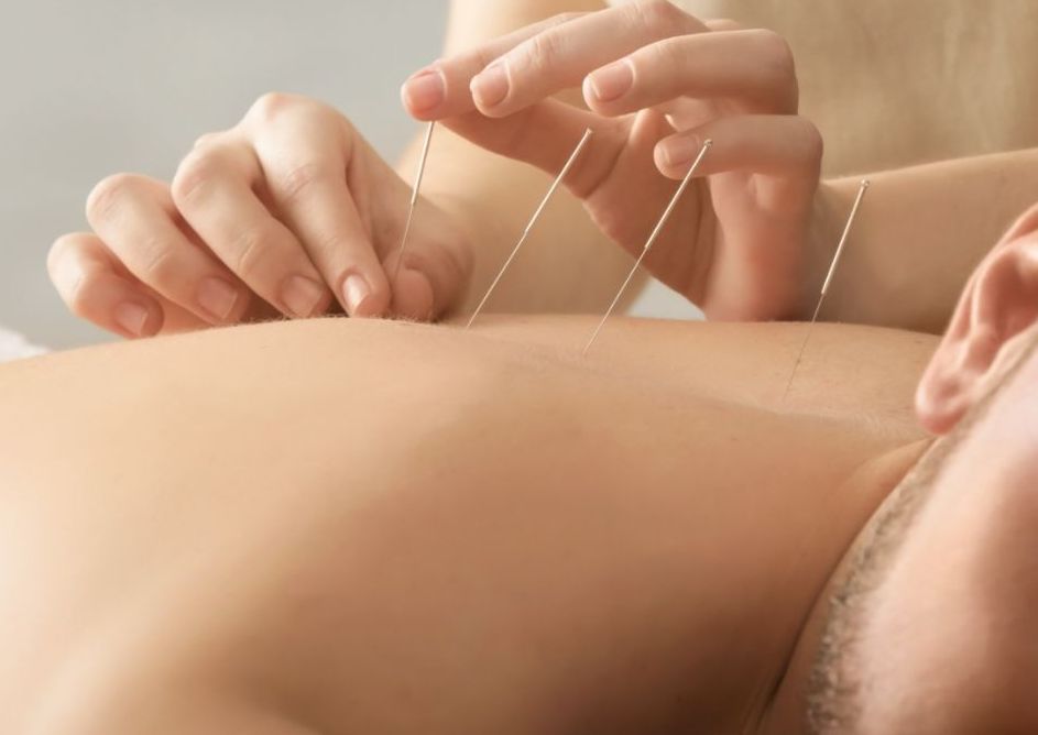 New Patient Acupuncture