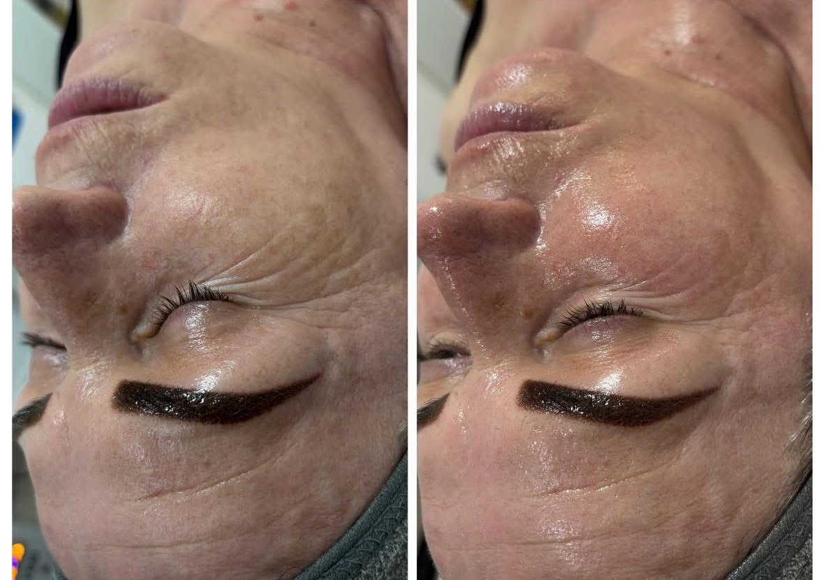 Tratament Facial MyCodeAdvance