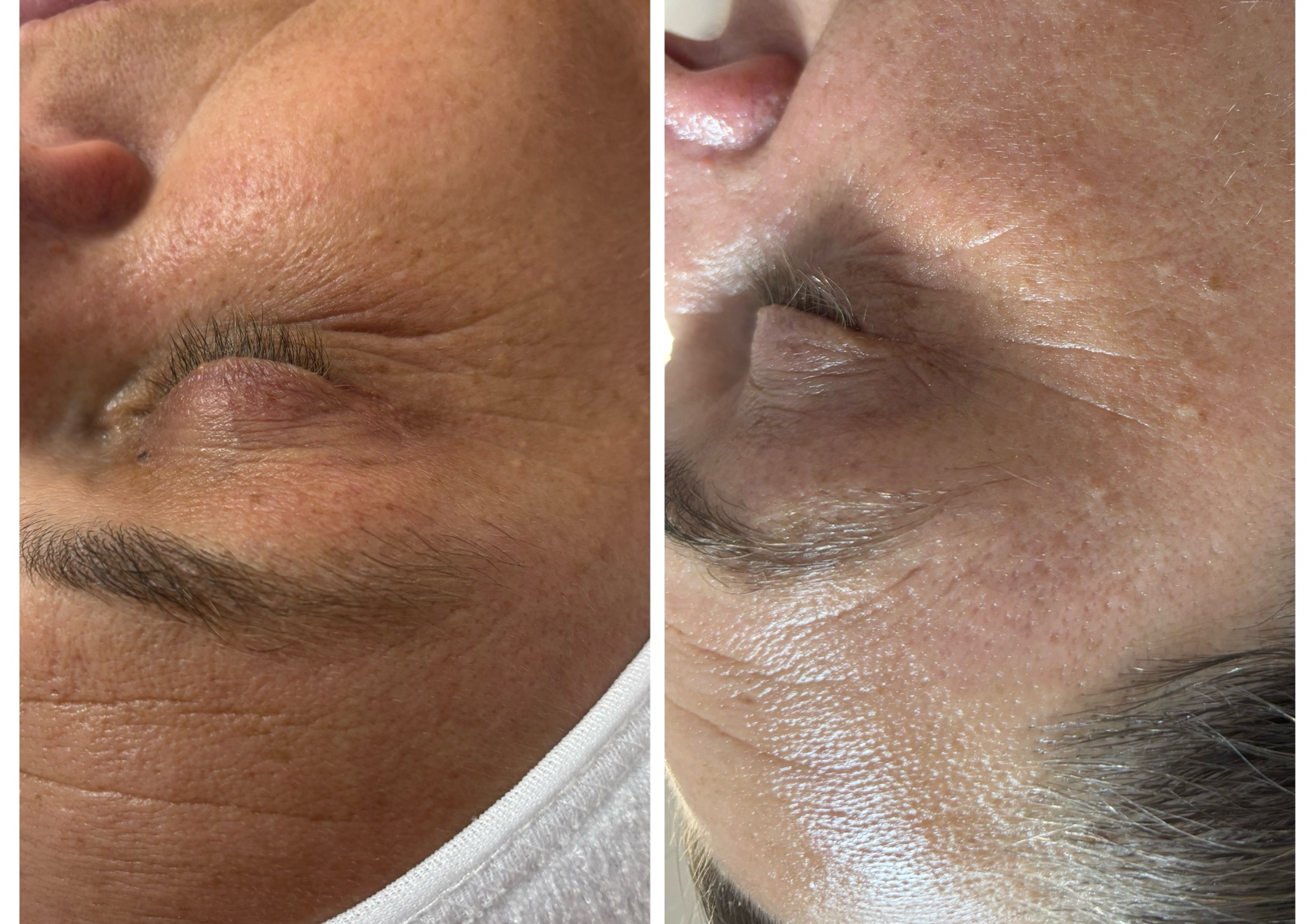 MyCode+RF Lab Radiofrecventa