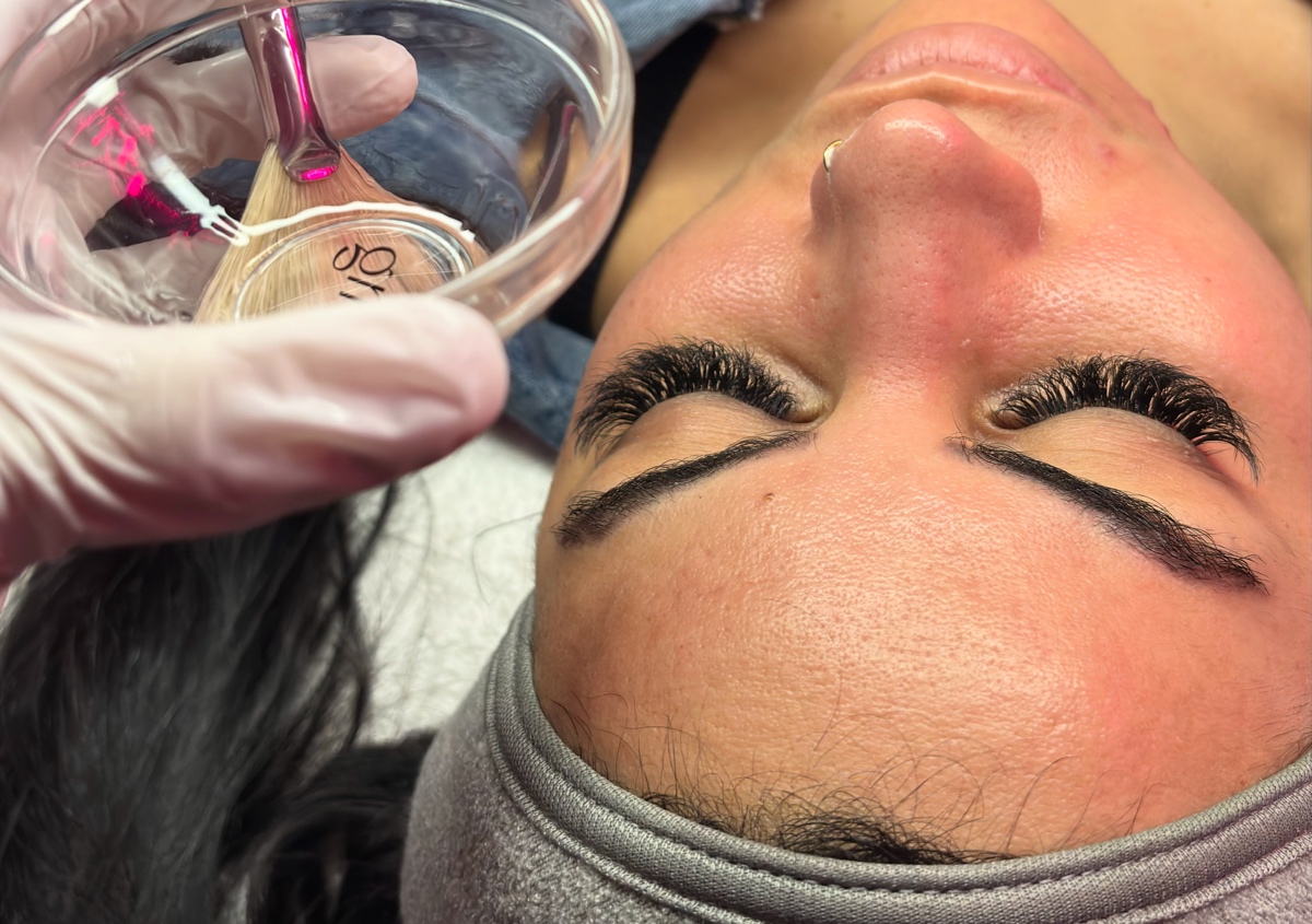 SkinPeel Facial