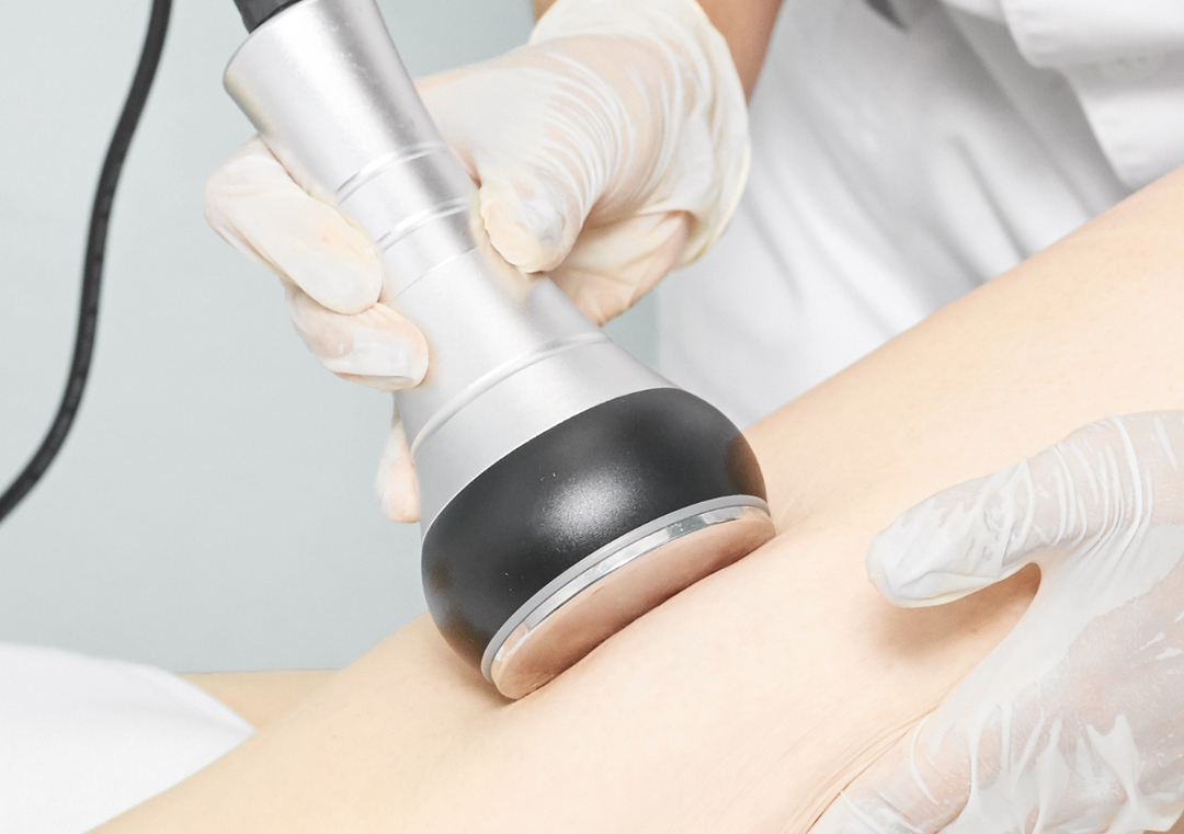 Cavitación Reductora 