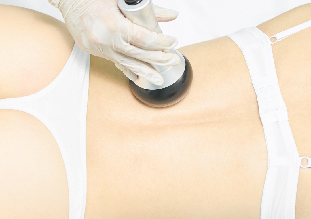 Vacunterapia Anticelulitis 