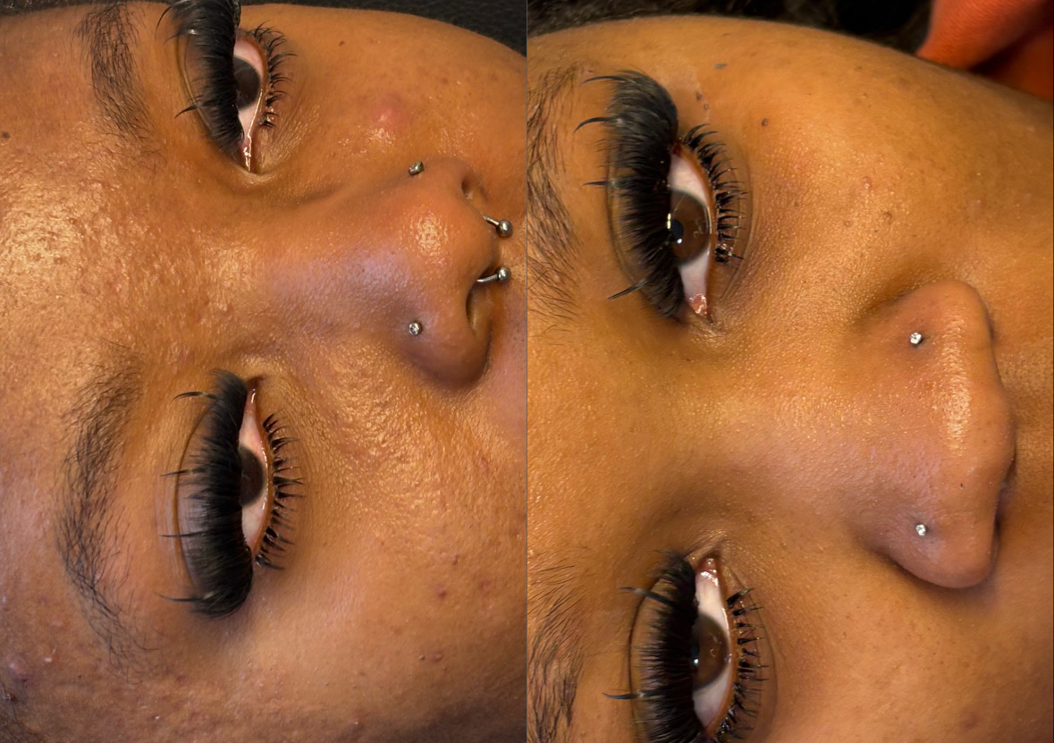 Volume set + spikes & individual bottoms