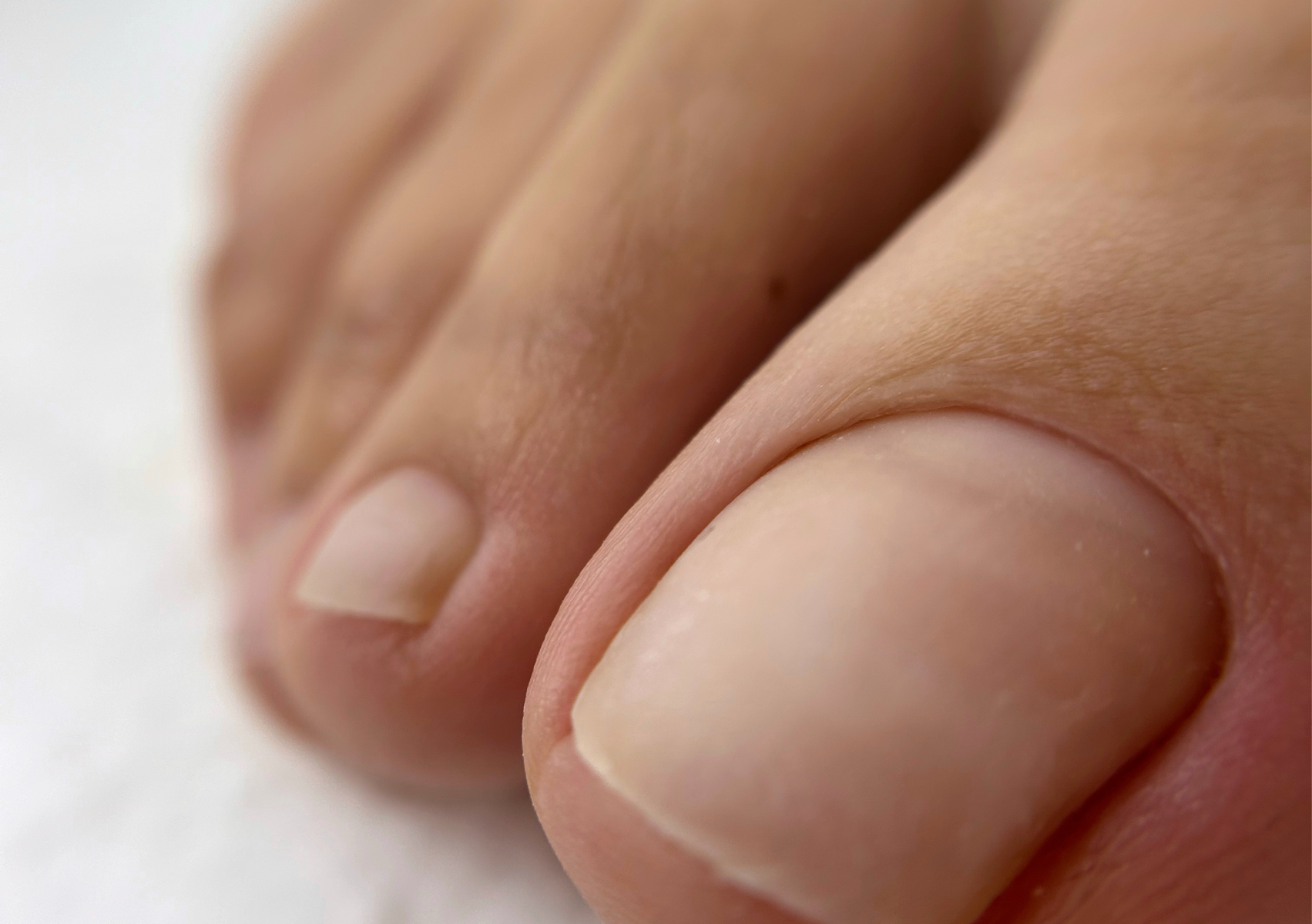 Pedichiură Necesară