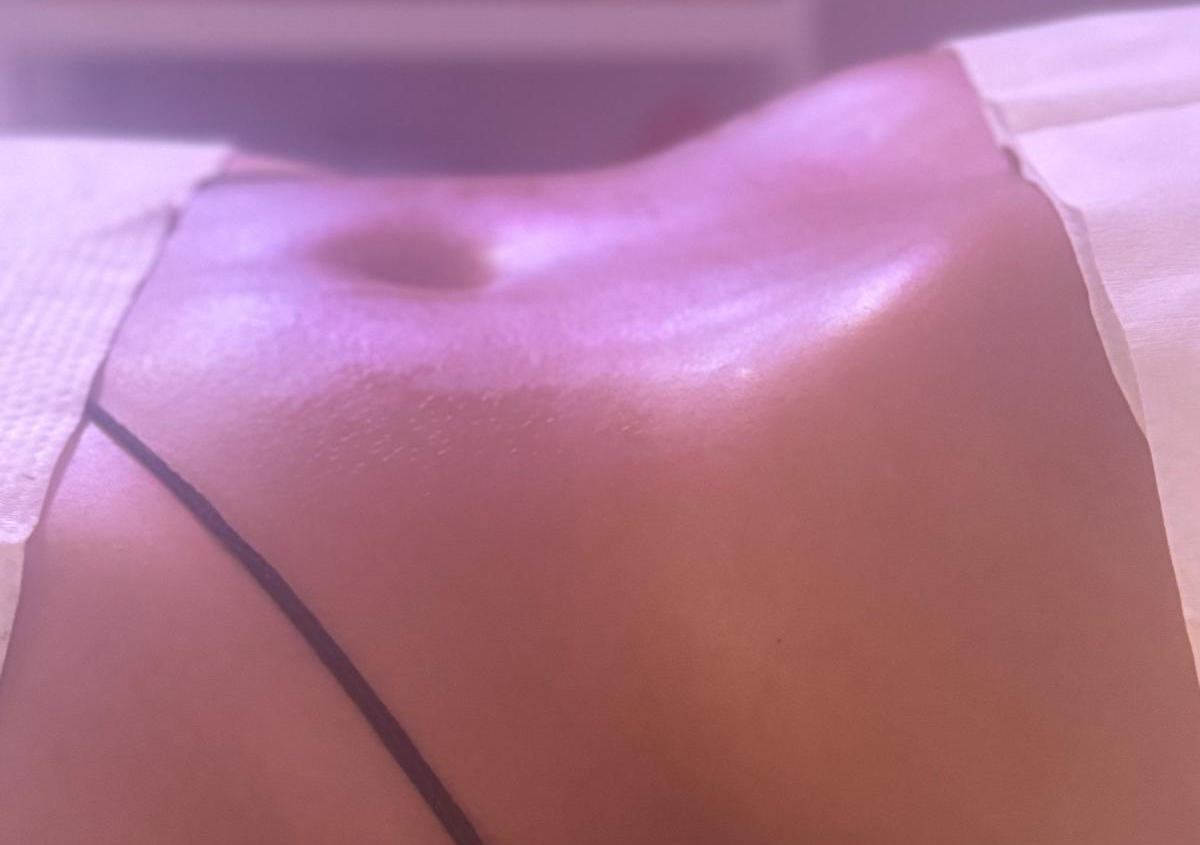 Tratamiento Corporal Personalizado 6 sesiones Full Body