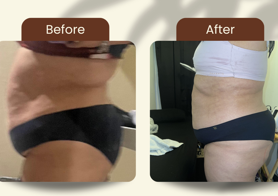 LipoActivex (2) 