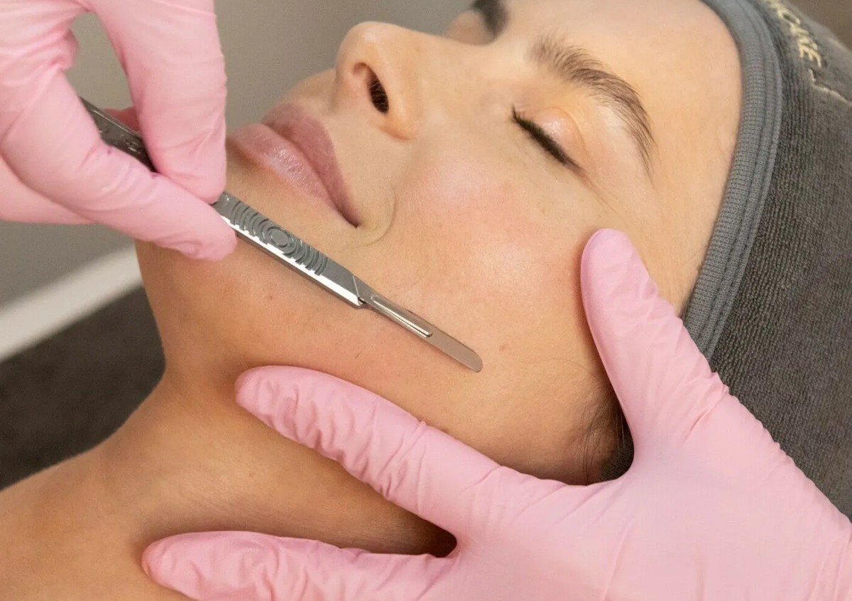 Facial Dermaplaning 