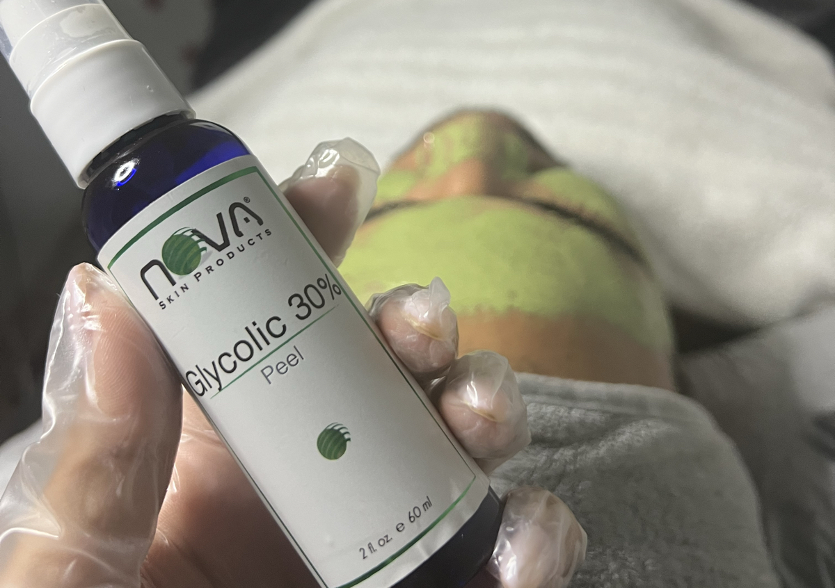 Facial Peeling Quimico 