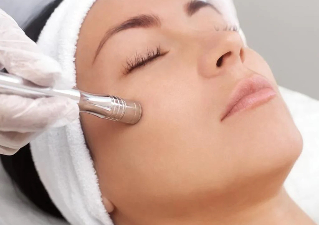 Facial microdermoabrasion (martes) 