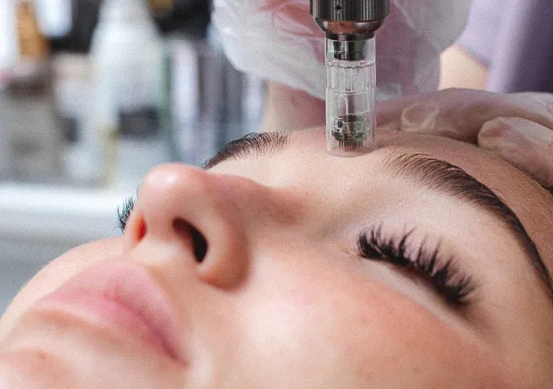 Facial Microagujas 