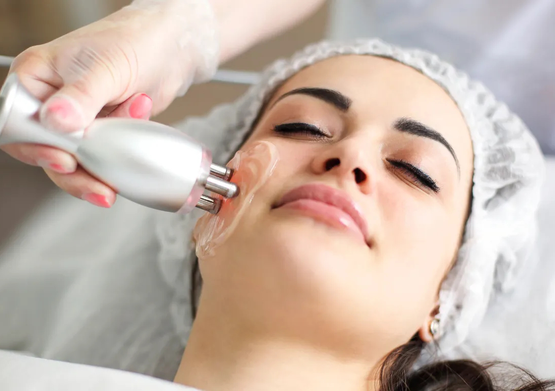 Radiofrecuencia Facial 