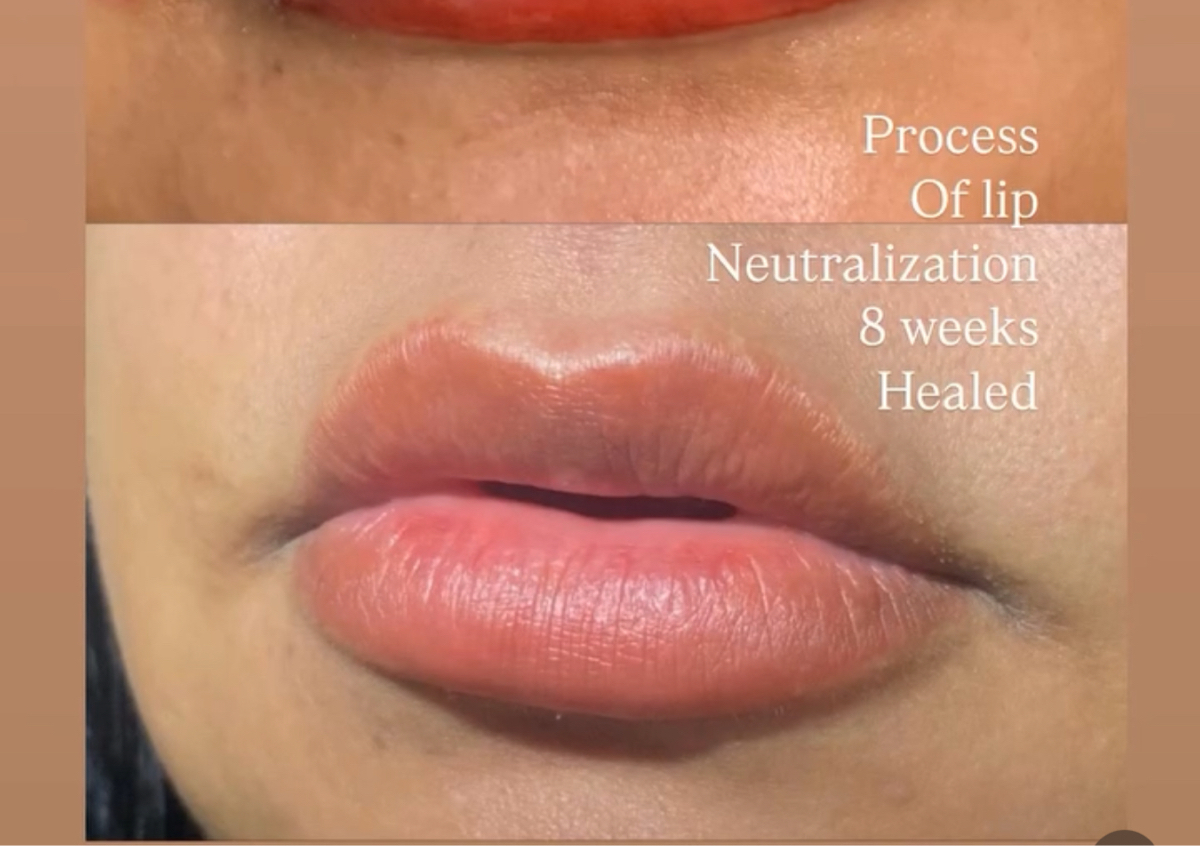 Dark lip blush neutralization