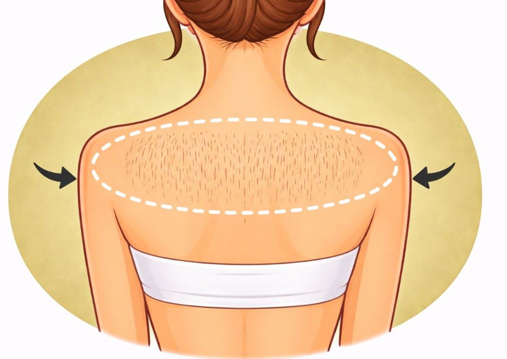 Upper Back